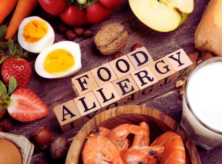 Allergie alimentari più comuni